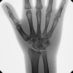 tau-2020-clinical-image-wrist-ap_web.480x480